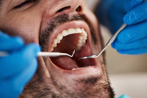 Best Emergency Dentist for Lost Fillings or Crowns in Conrad, IA